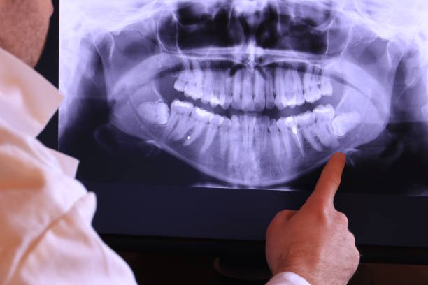 Best Emergency Dental Care for Broken or Chipped Teeth in Gillette, NJ