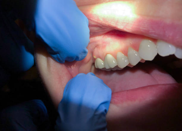 Best Emergency TMJ Treatment in Gillette, NJ